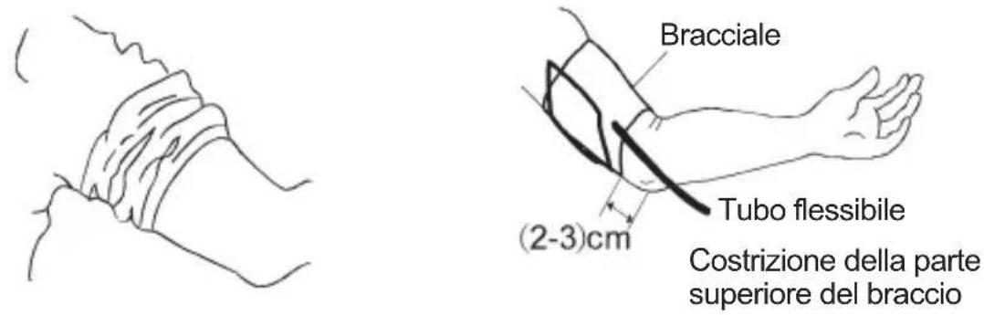 Sogo SS-14075W - ATTACCARE IL POLSINO DEL BRACCIO - 1