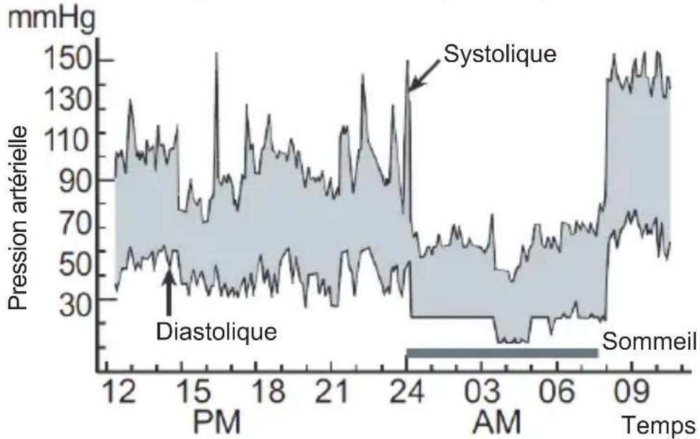 Sogo SS-14075W - Variations de la pression artérielle - 1