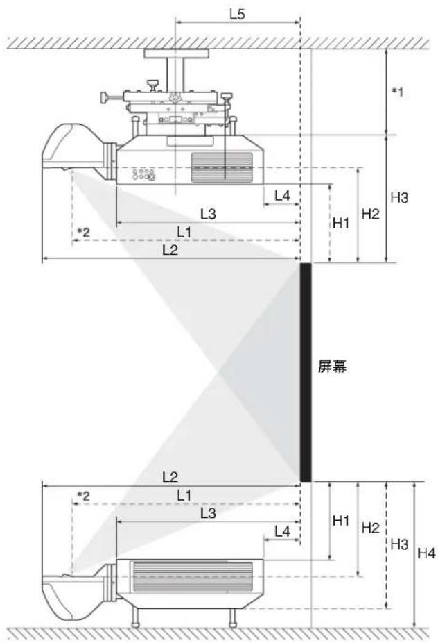 SONY VPLL-3003 - 调节支脚 - 2