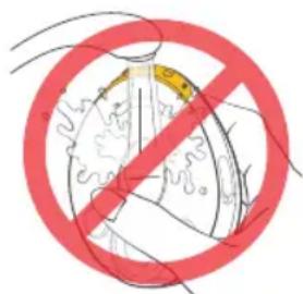 MEDELA Magic InBra - Procedura di pulizia - 1