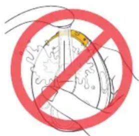 MEDELA Magic InBra - Motor Unit - 1