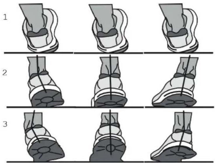 KETTLER Sprinter 1.1 - Pronation du pied - 1