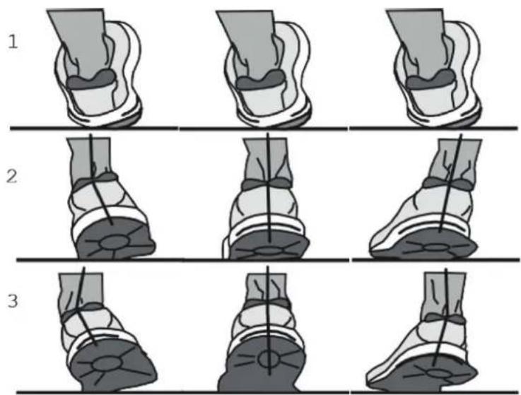 KETTLER Sprinter 1.1 - Pronation of the foot - 1