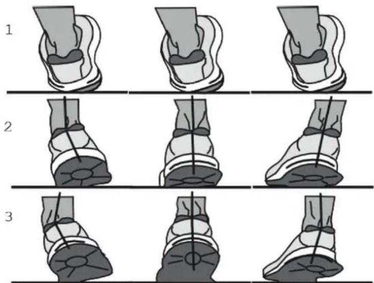 KETTLER Sprinter 1.1 - Pronation des Fubes - 1