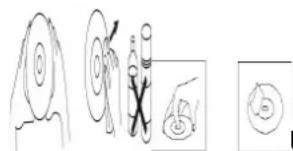 Silva Schneider PCD 19.1 - Treating a CD: - 4