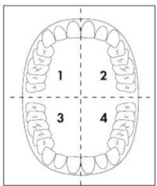NEVADENT NSZB 3.7 B2 - HINWEIS - 1