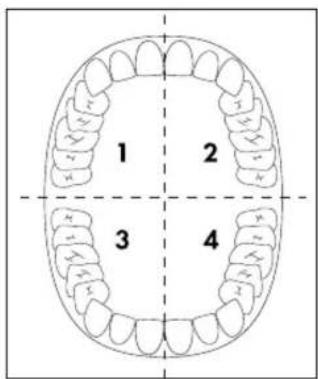 NEVADENT NSZB 3.7 B3 - HINWEIS - 1