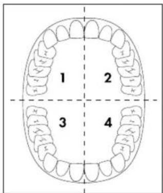 NEVADENT NSZB 3.7 B3 - REMARQUE - 1