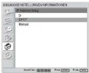 SONY FWD-32LX1R - Automatisches Beziehen einer IP-Adresse (DHCP) - 3