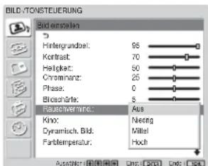 SONY FWD-32LX1R - Rauschvermind. - 1