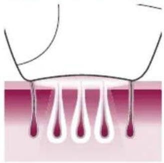 PHILIPS Lumea Advanced BRI920/00 light depilation - Hoe IPL werkt - 1