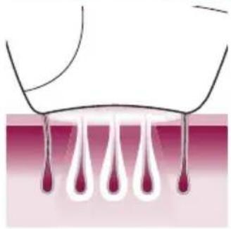 PHILIPS Lumea Advanced BRI920/00 light depilation - Funzionamento della tecnologia IPL - 1
