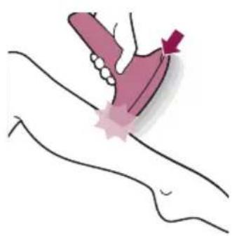 PHILIPS Lumea Advanced BRI920/00 light depilation - Het apparaat gebruiken - 3