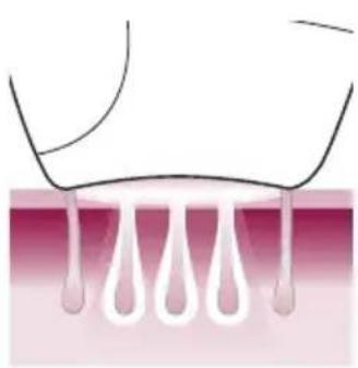 PHILIPS Lumea Advanced BRI920/00 light depilation - So funktioniert IPL - 3
