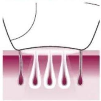 PHILIPS Lumea Advanced BRI920/00 light depilation - How IPL works - 1