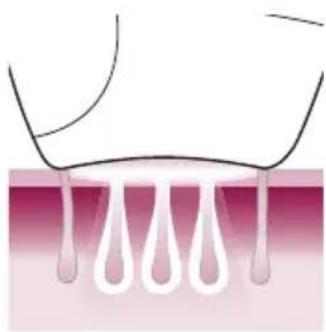 PHILIPS Lumea Advanced BRI920/00 light depilation - Hoe IPL werkt - 3