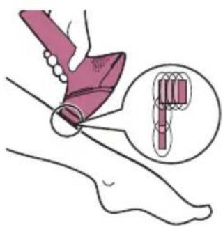 PHILIPS Lumea Advanced BRI920/00 light depilation - Manipulation de l'appareil - 5
