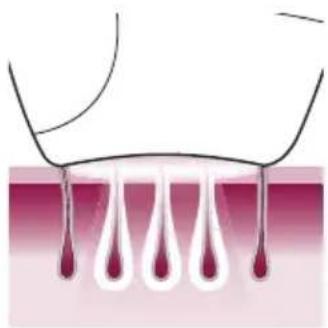 PHILIPS Lumea Advanced BRI920/00 light depilation - So funktioniert IPL - 1