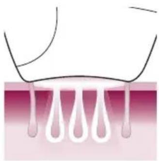 PHILIPS Lumea Advanced BRI920/00 light depilation - How IPL works - 3