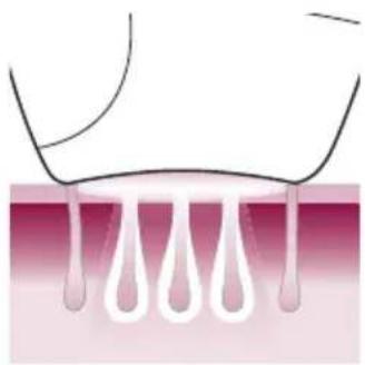 PHILIPS Lumea Advanced BRI920/00 light depilation - Principe de fonctionnement de la lumière pulsée intense - 3