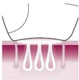 PHILIPS Lumea Advanced BRI920/00 light depilation - Funzionamento della tecnologia IPL - 3