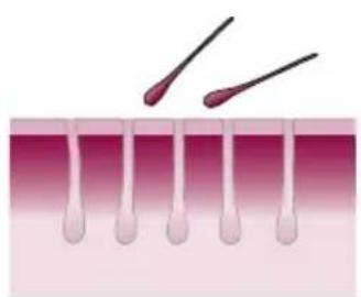 PHILIPS Lumea Advanced BRI920/00 light depilation - How IPL works - 2