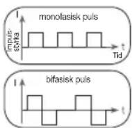 BEURER EM 1 R - Impulsform - 1