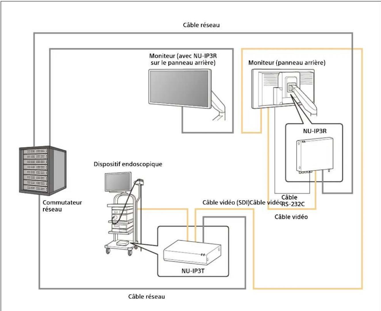 SONY NU-IP3R - Exemple de configuration du système - 1