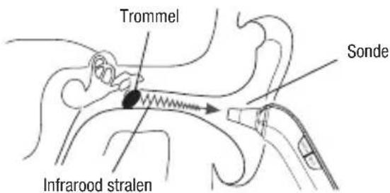 TERRAILLON Thermo Fast - OPGELET: - 1