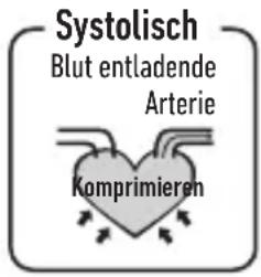 HOMEDICS BPA-420 - ACHTUNG - 1