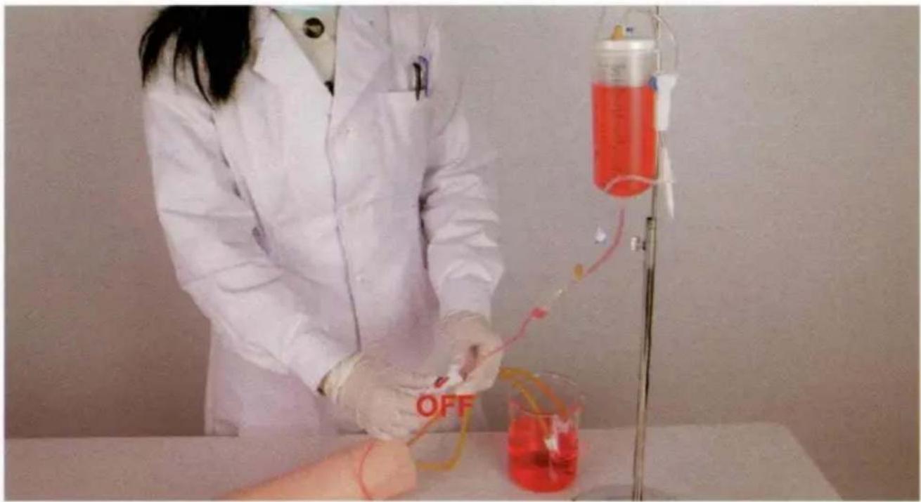 Vevor LD-HS1 - Bluttransfusion: - 1