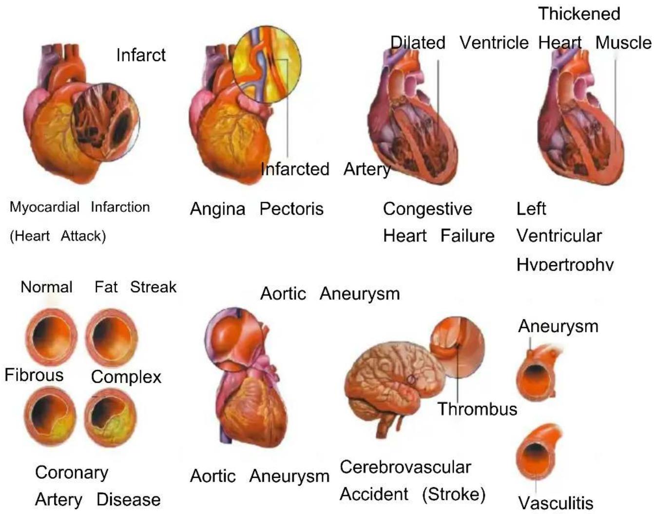 Vevor LD-3JT - Skeletal Anatomy - 29