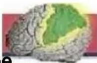 Vevor LD-3JT - 1.Frontal lobe - 1