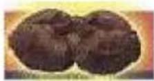 Vevor LD-3JT - Lobo parietale - 2
