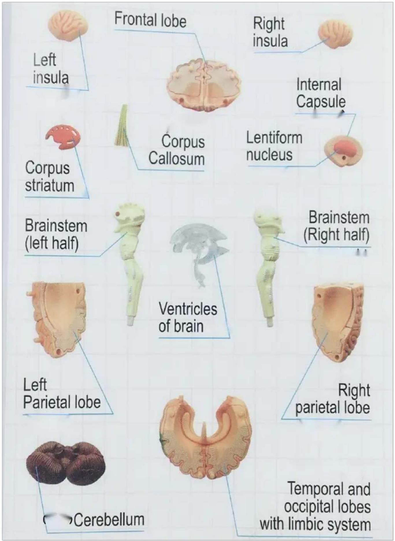 Vevor LD-3JT - 9.Brainstem - 1