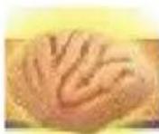 Vevor LD-3JT - Corpus Callosum Dit - 1