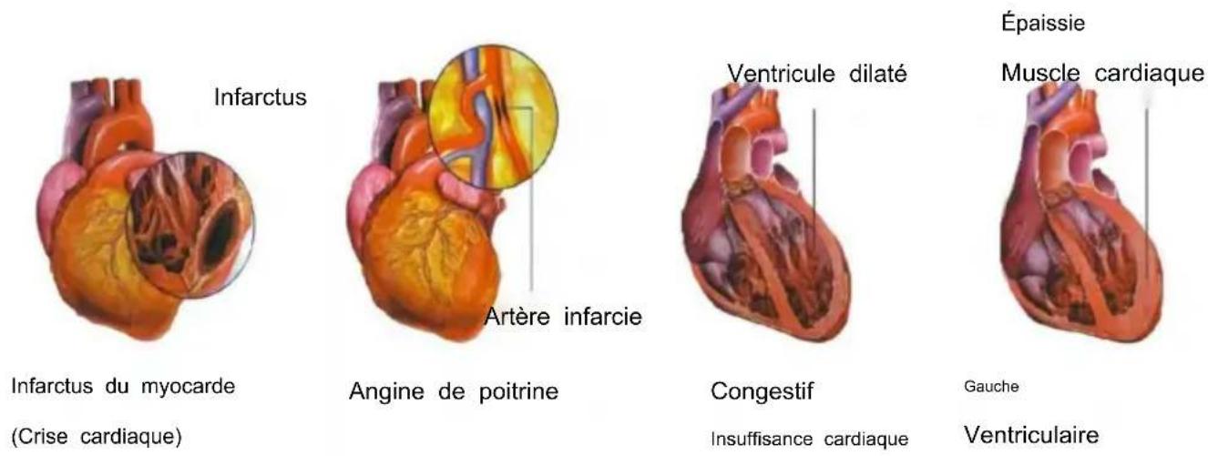 Vevor LD-3JT - Anatomie du - 19
