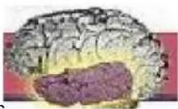 Vevor LD-3JT - 4.Corpus striatum Die - 2