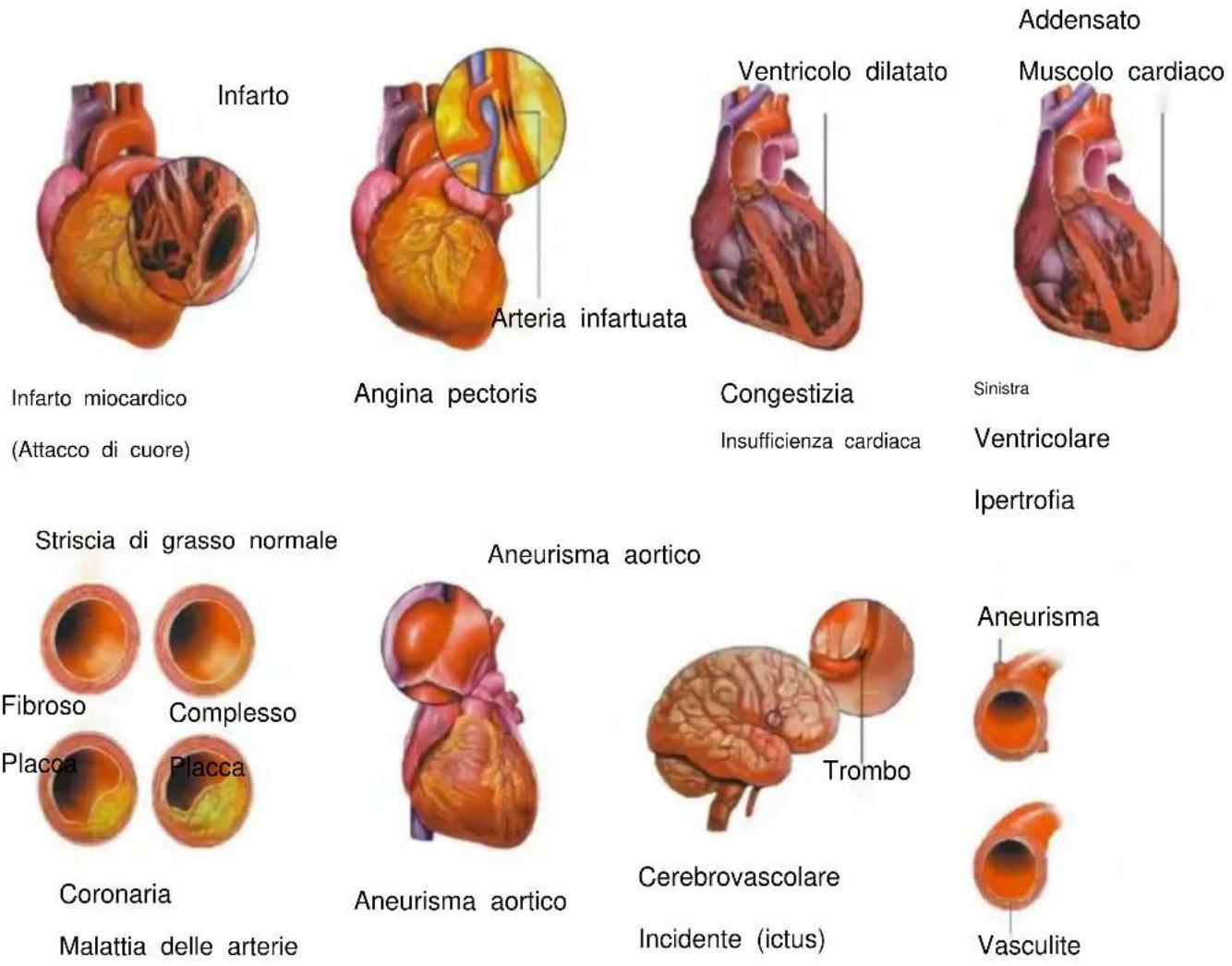 Vevor LD-3JT - Anatomia - 19