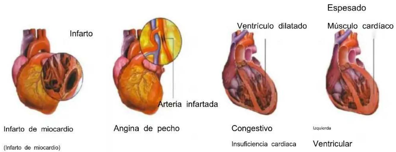 Vevor LD-3JT - Anatomía del - 19