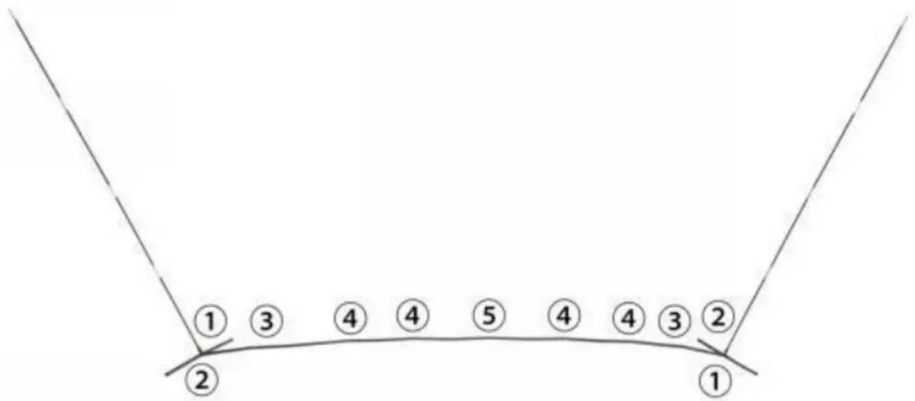 Vevor SSPDYBQ006 - Schematic diagram of the stent installation - 1
