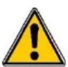 Vevor Z1Z-CF-9150 - NEED HELP? CONTACT US! - 1