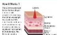 Vevor RL05-B - Red Light Face Massager Model: RL05-B - 5