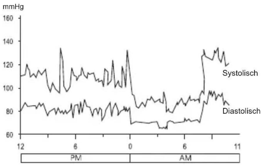 Geratherm Active Control - Bloeddrukschommelingen en -veranderingen - 1