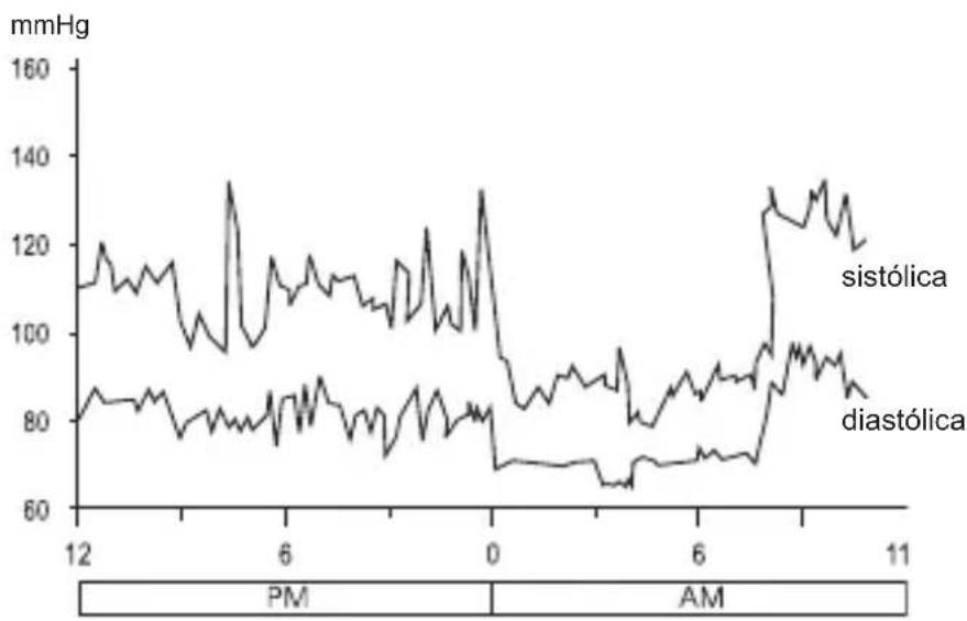 Geratherm Active Control - Fluctuaciones y cambios de la presión arterial - 1