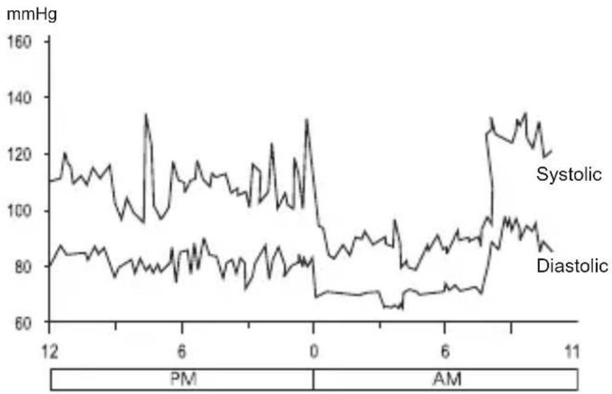 Geratherm Active Control - Fluctuation and variation in blood pressure - 2