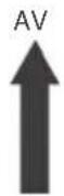 Vevor SDC-60A - DIP-omkopplare - 3