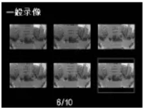 PHILIPS ADR900 - 锁定视频 - 1