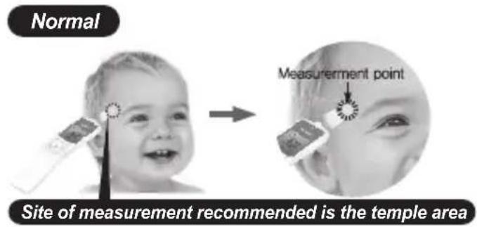 Normal Measurement point Site of measurement recommended is the temple area