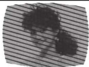 Black-and-white photo of a person with dark hair against a striped background (no text or symbols visible)